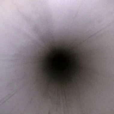 Endoscope lumen view 1