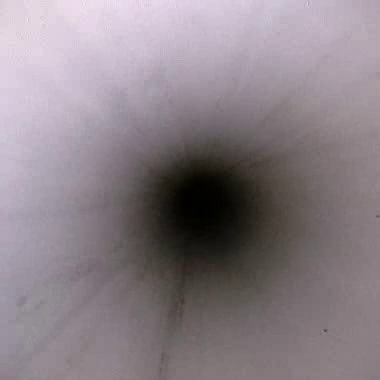 Endoscope lumen view 2