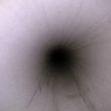 Endoscope lumen view 3