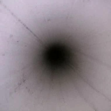 Endoscope lumen view 4