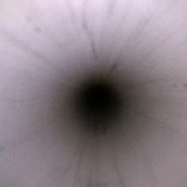 Endoscope lumen view 5