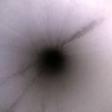 Endoscope lumen view 6