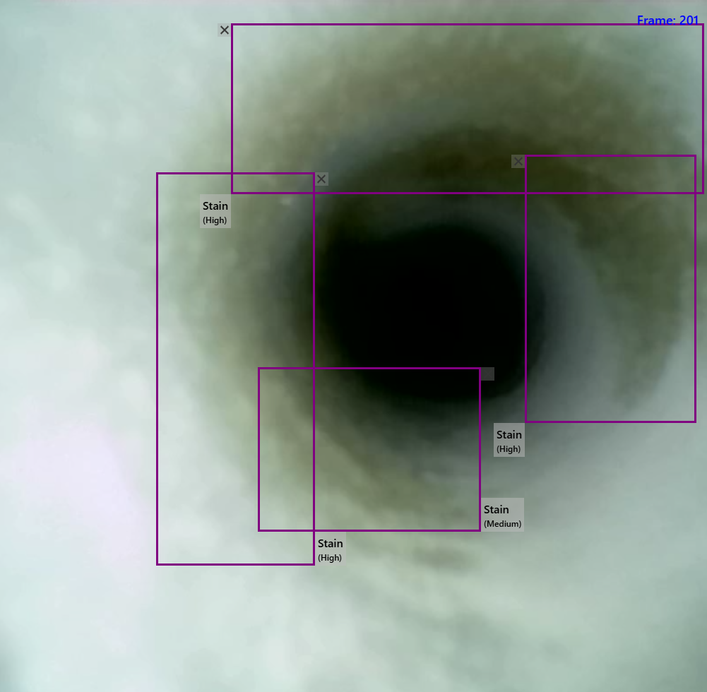 AI detection example: Lint & Fibers