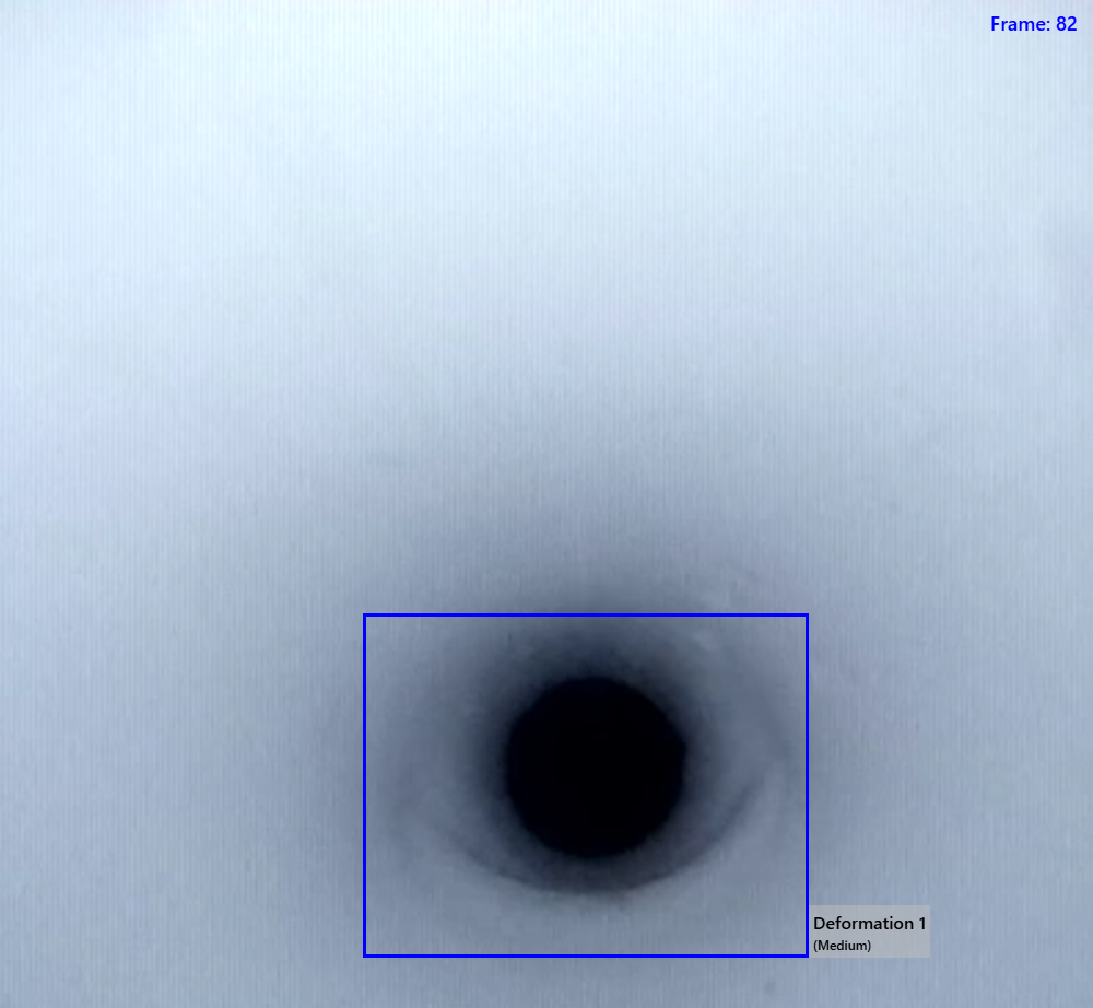 AI detection example: Tube Deformity